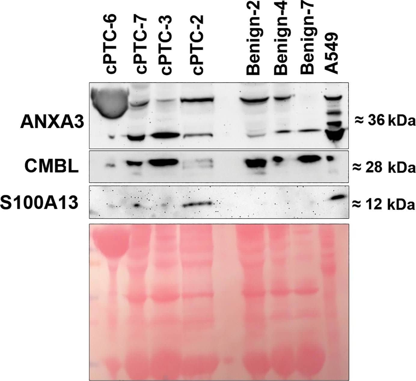 Western Blot S100A13 Antibody