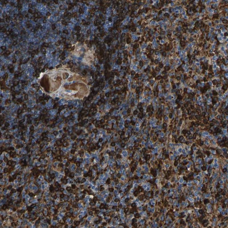 Staining of human spleen shows strong cytoplasmic positivity in cells of both red and white pulp.