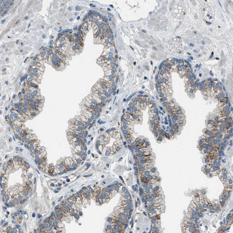 Staining of human prostate shows shows moderate granular cytoplasmic positivity in glandular cells.