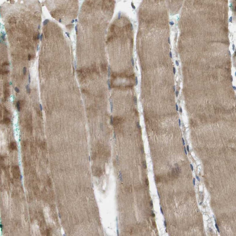 Immunohistochemistry-Paraffin SCN4B Antibody - BSA Free