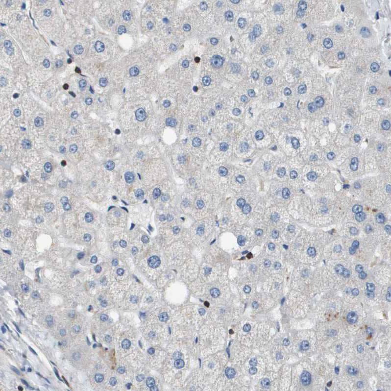Staining of human liver shows no positivity in hepatocytes as expected.