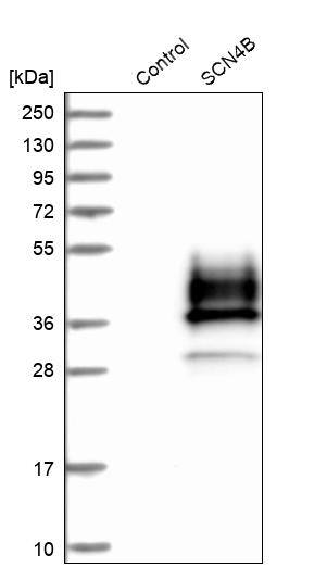 Analysis in control (vector only transfected HEK293T lysate) and SCN4B over-expression lysate (Co-expressed with a C-terminal myc-DDK tag (~3.1 kDa) in mammalian HEK293T cells).