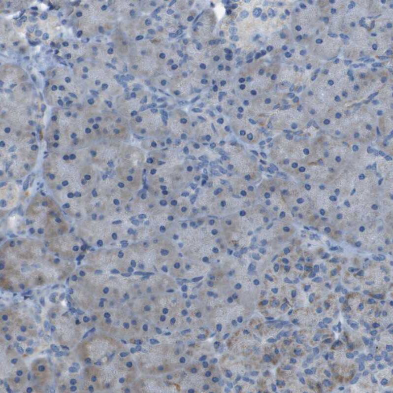 Immunohistochemistry-Paraffin GALNT6 Antibody - BSA Free
