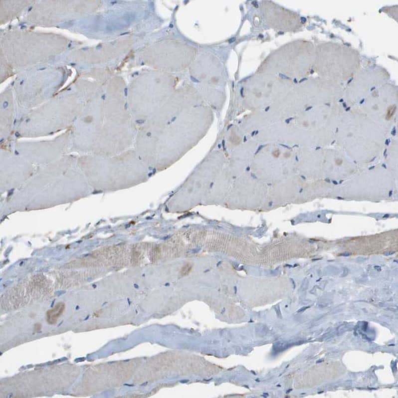 Immunohistochemistry-Paraffin GALNT6 Antibody - BSA Free