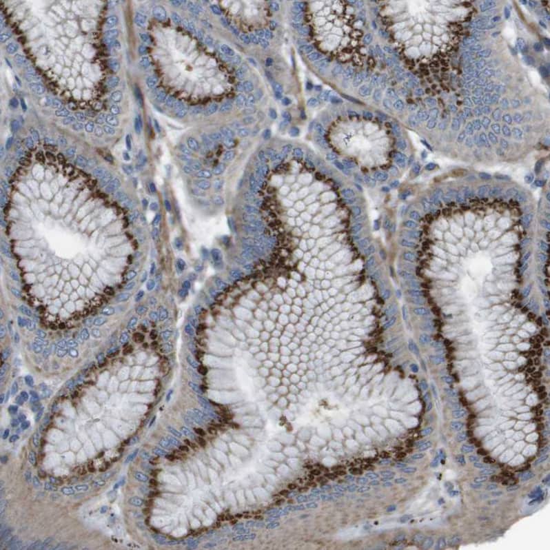 Immunohistochemistry-Paraffin GALNT6 Antibody - BSA Free