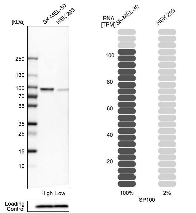 Analysis in human cell lines SK-MEL-30 and HEK293 using Anti-SP100 antibody. Corresponding SP100 RNA-seq data are presented for the same cell lines. Loading control: Anti-PFN1.