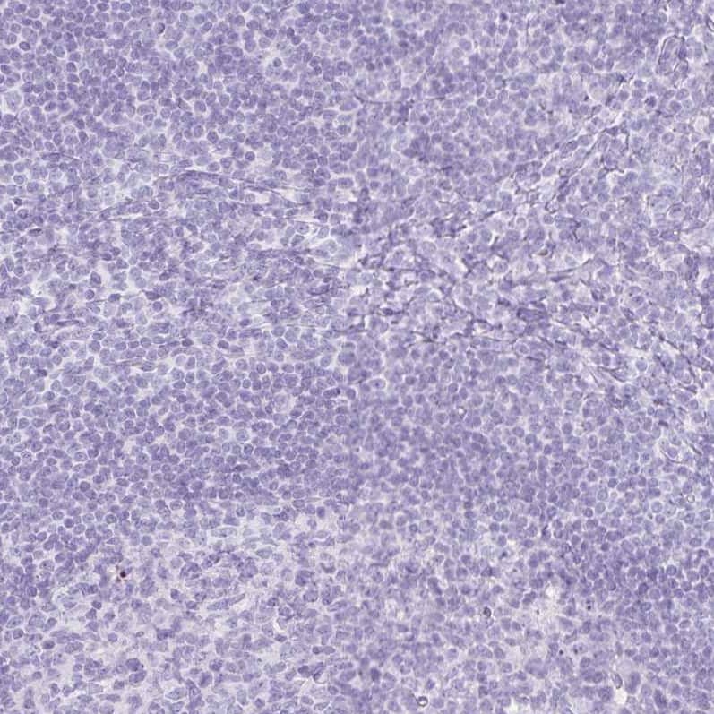Immunohistochemistry-Paraffin GP2 Antibody - BSA Free