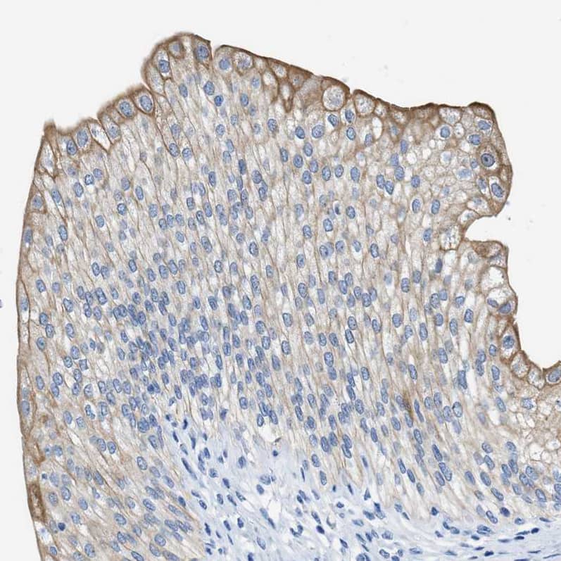 Staining of human urinary bladder shows weak to moderate cytoplasmic positivity in urothelial cells.
