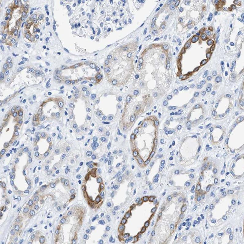 Staining of human kidney shows weak to moderate cytoplasmic positivity in cells in tubules.