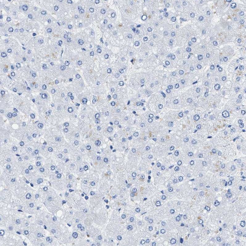 Staining of human liver shows no positivity in hepatocytes as expected.