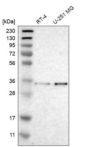 Analysis in human cell line RT-4 and human cell line U-251 MG.