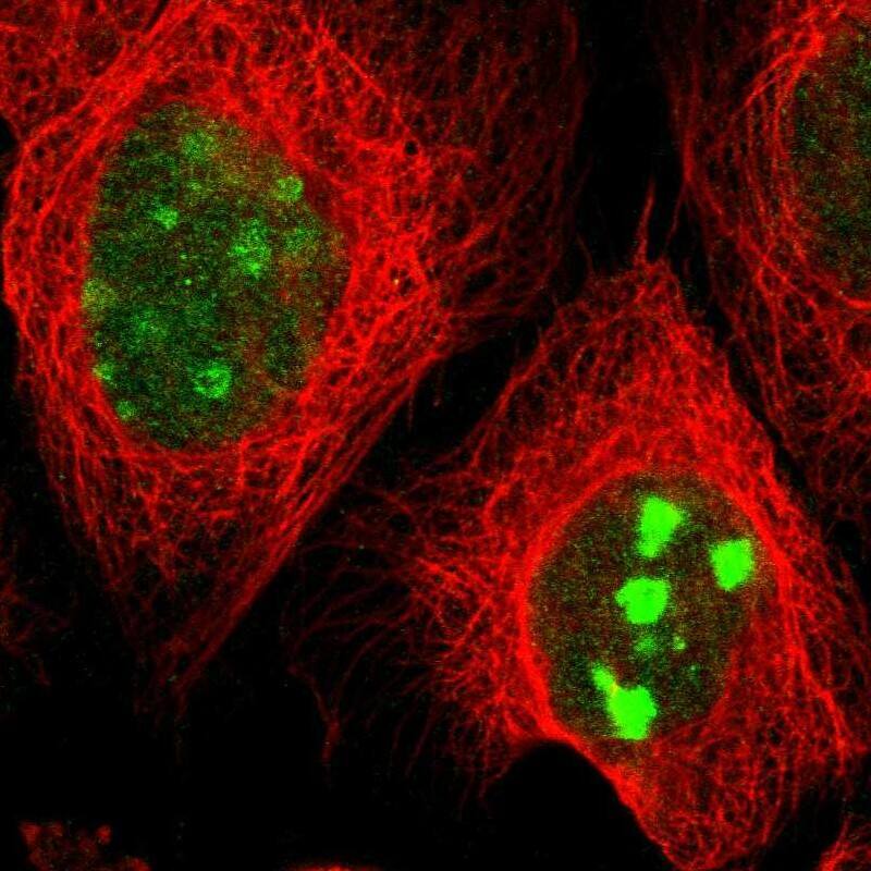 Staining of human cell line A-431 shows localization to nucleus & nucleoli.