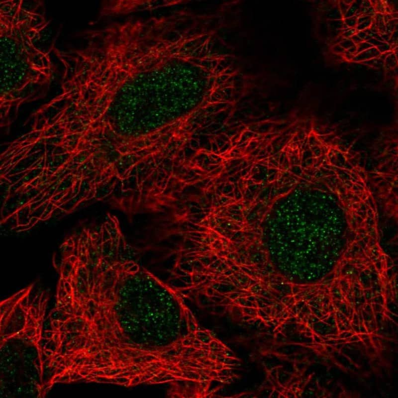 Staining of human cell line A549 shows localization to nucleoplasm.