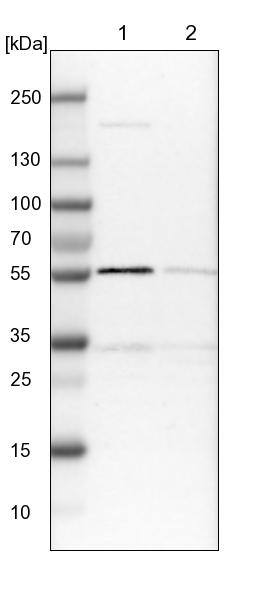 Lane 1: NIH-3T3 cell lysate (Mouse embryonic fibroblast cells)Lane 2: NBT-II cell lysate (Rat Wistar bladder tumour cells)