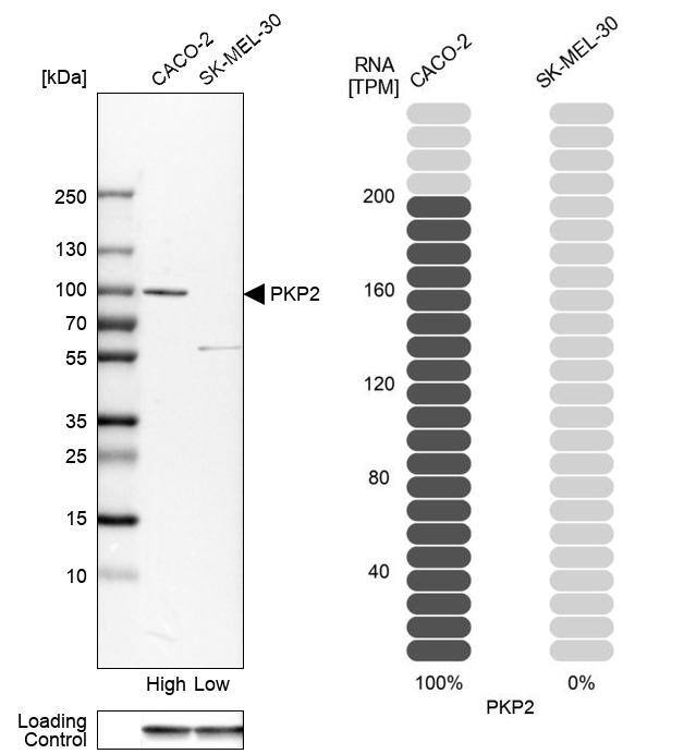Analysis in human cell lines Caco-2 and SK-MEL-30 using Anti-PKP2 antibody. Corresponding PKP2 RNA-seq data are presented for the same cell lines. Loading control: Anti-GAPDH.