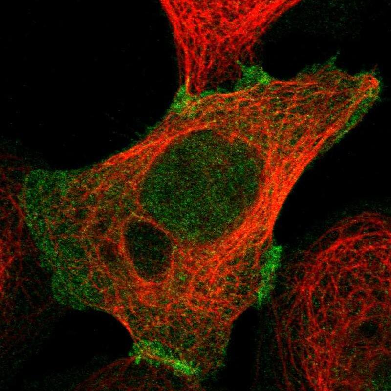 Staining of human cell line A-431 shows localization to nucleoplasm & cell junctions.