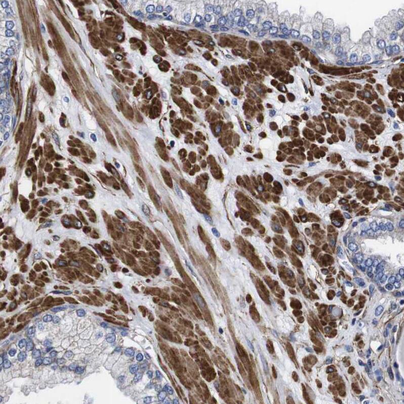 Staining of human prostate shows strong cytoplasmic positivity in smooth muscle cells.