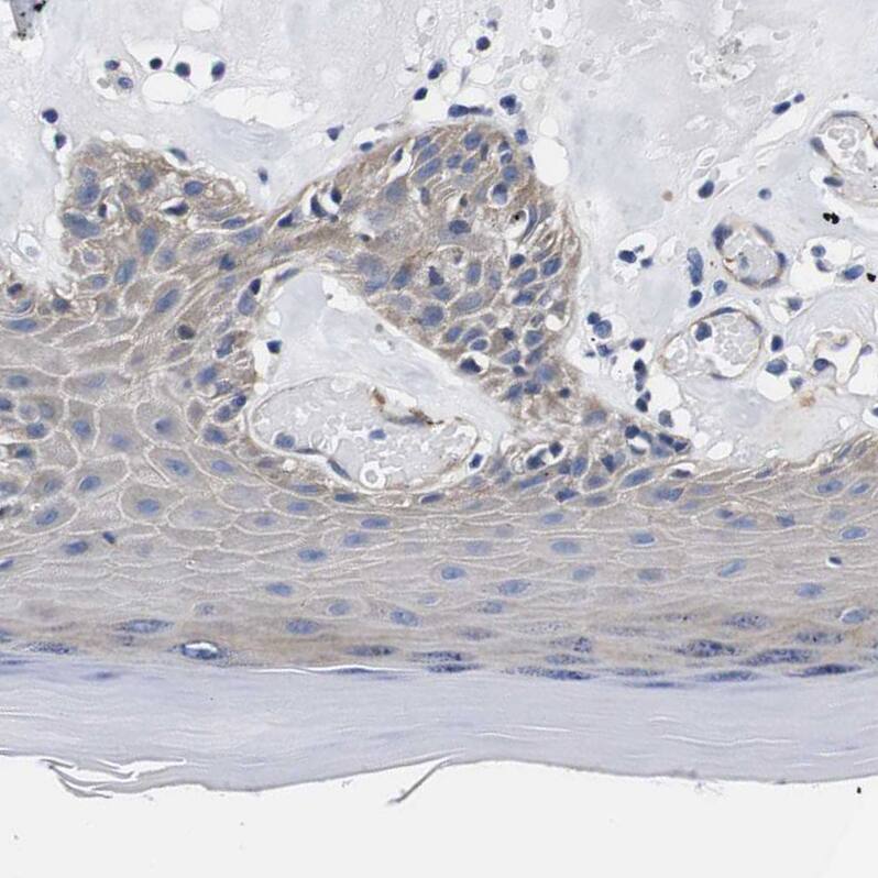 Staining of human skin shows weak cytoplasmic positivity in squamous epithelial cells.