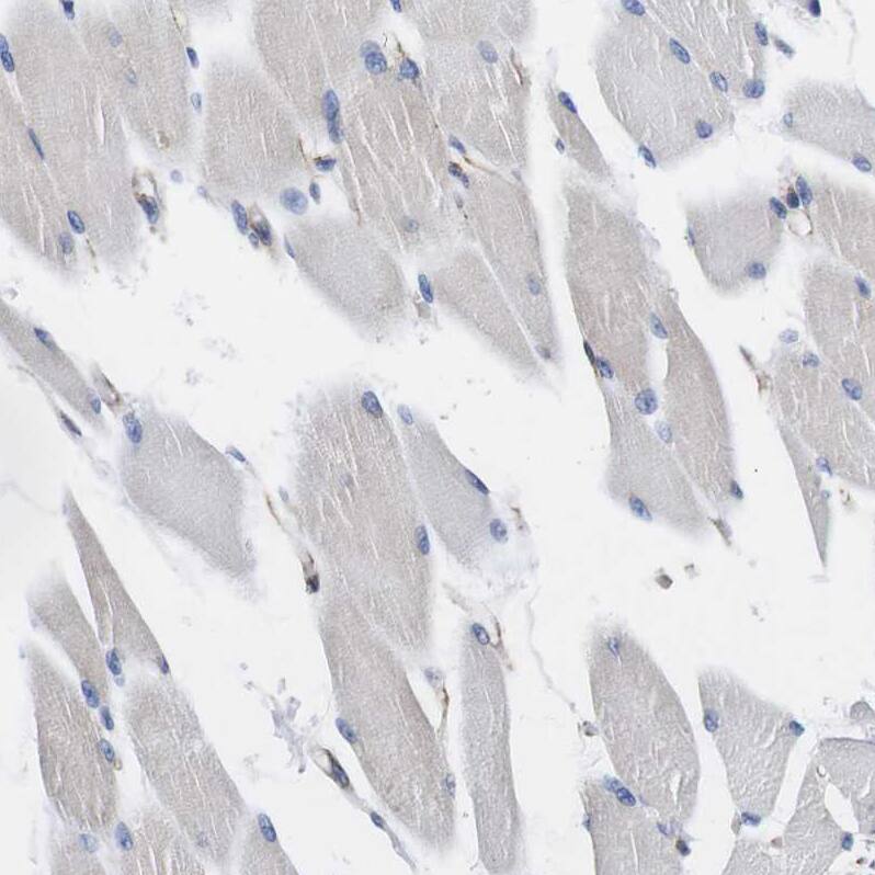 Staining of human skeletal muscle shows no positivity in myocytes as expected.