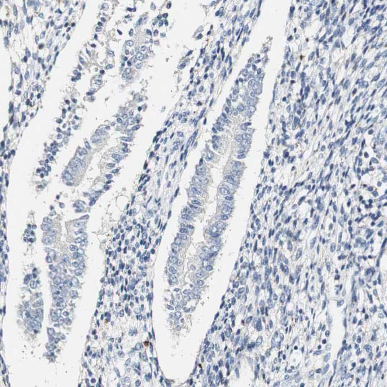 Staining of human endometrium shows no positivity in glandular cells.