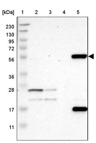 Lane 1: Marker [kDa] 230, 130, 95, 72, 56, 36, 28, 17, 11Lane 2: Human cell line RT-4Lane 3: Human cell line U-251MG spLane 4: Human plasma (IgG/HSA depleted)Lane 5: Human liver tissue