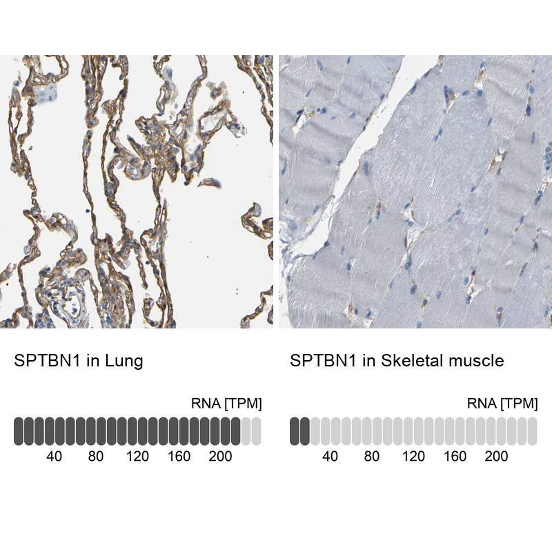 Immunohistochemistry-Paraffin Spectrin beta 2 Antibody - BSA Free