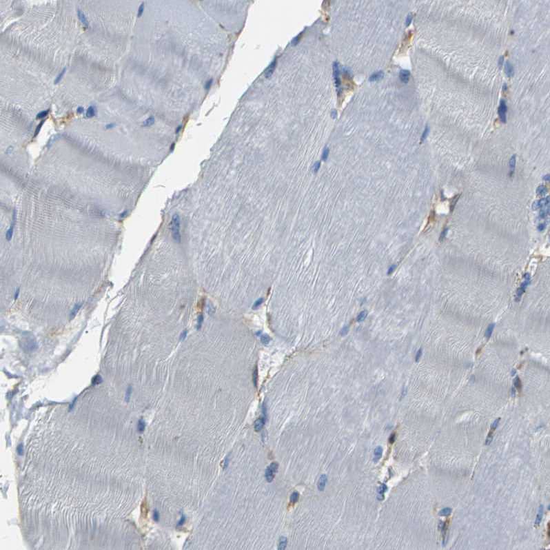 Staining of human skeletal muscle shows no positivity in myocytes as expected.