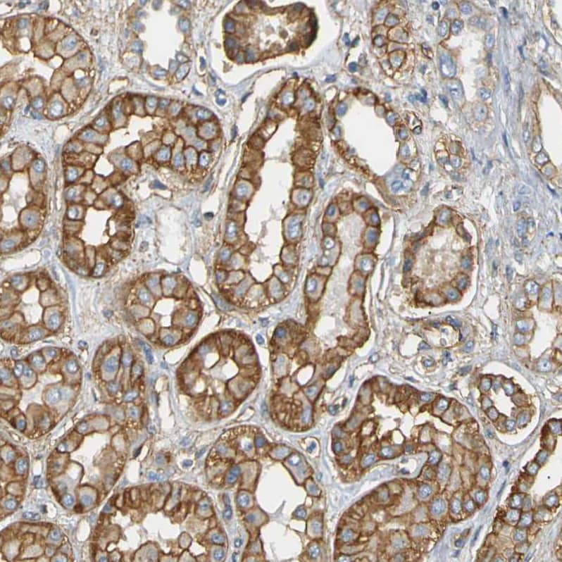 Staining of human kidney shows moderate to strong membranous positivity in cells in tubules.