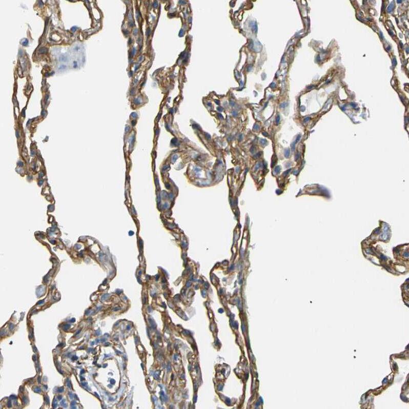 Staining of human lung shows strong positivity in respiratory epithelial cells.