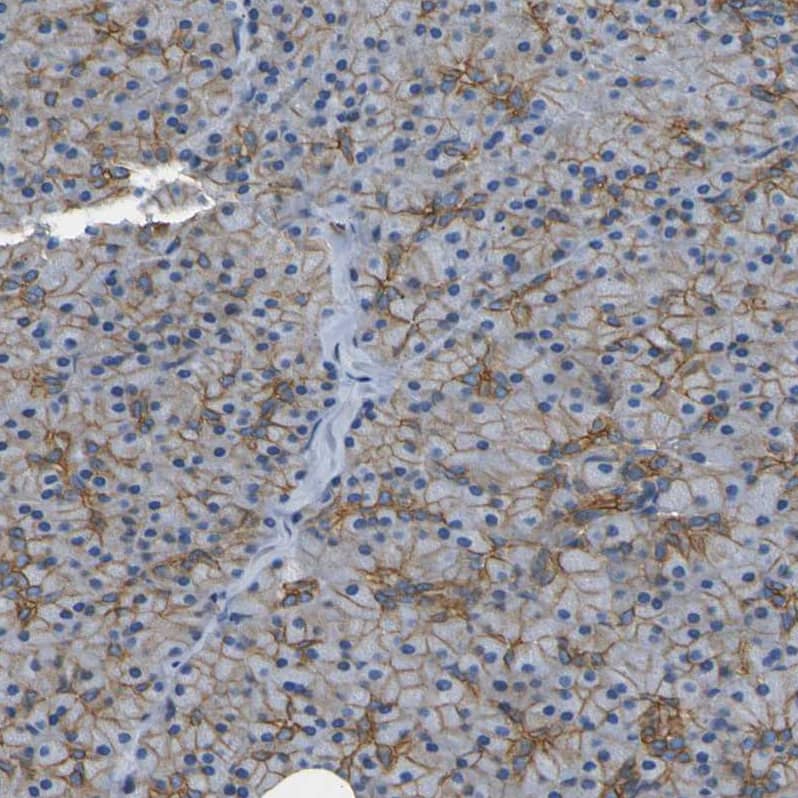 Staining of human pancreas shows moderate membranous positivity in exocrine glandular cells.