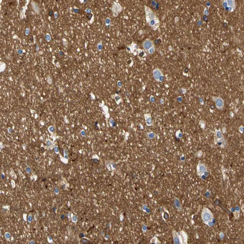 Staining of human cerebral cortex shows strong positivity in neuropil.