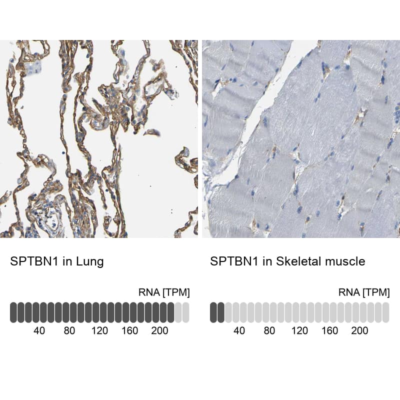 Immunohistochemistry analysis in human lung and skeletal muscle tissues using HPA012685 antibody. Corresponding SPTBN1 RNA-seq data are presented for the same tissues.