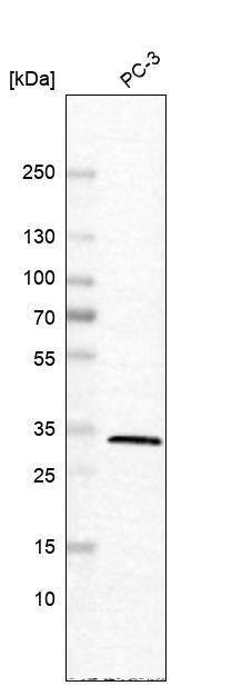 Analysis in human cell line PC-3.