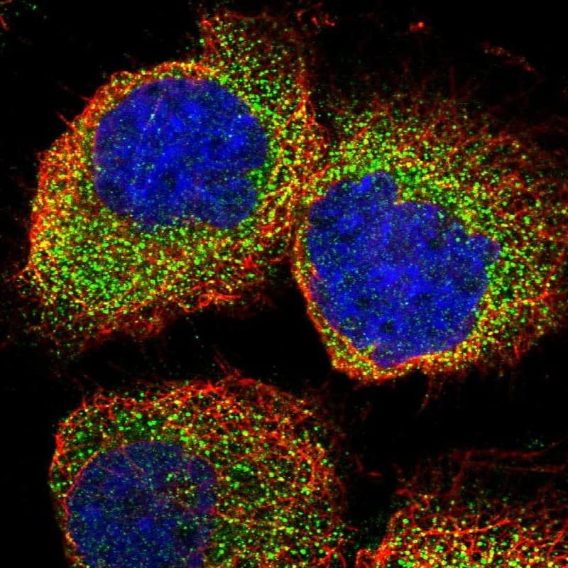 Staining of human cell line A-431 shows localization to cytosol.