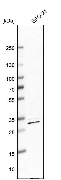 Analysis in human cell line EFO-21.