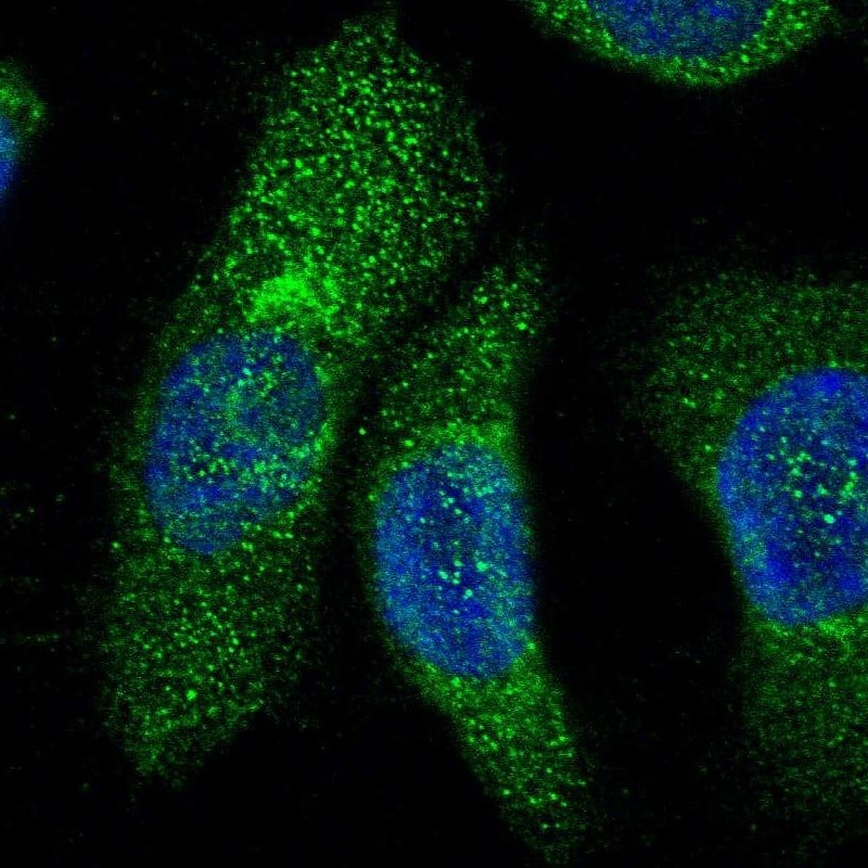Staining of human cell line A-431 shows localization to endoplasmic reticulum.