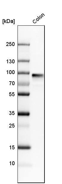 Analysis in human colon tissue.