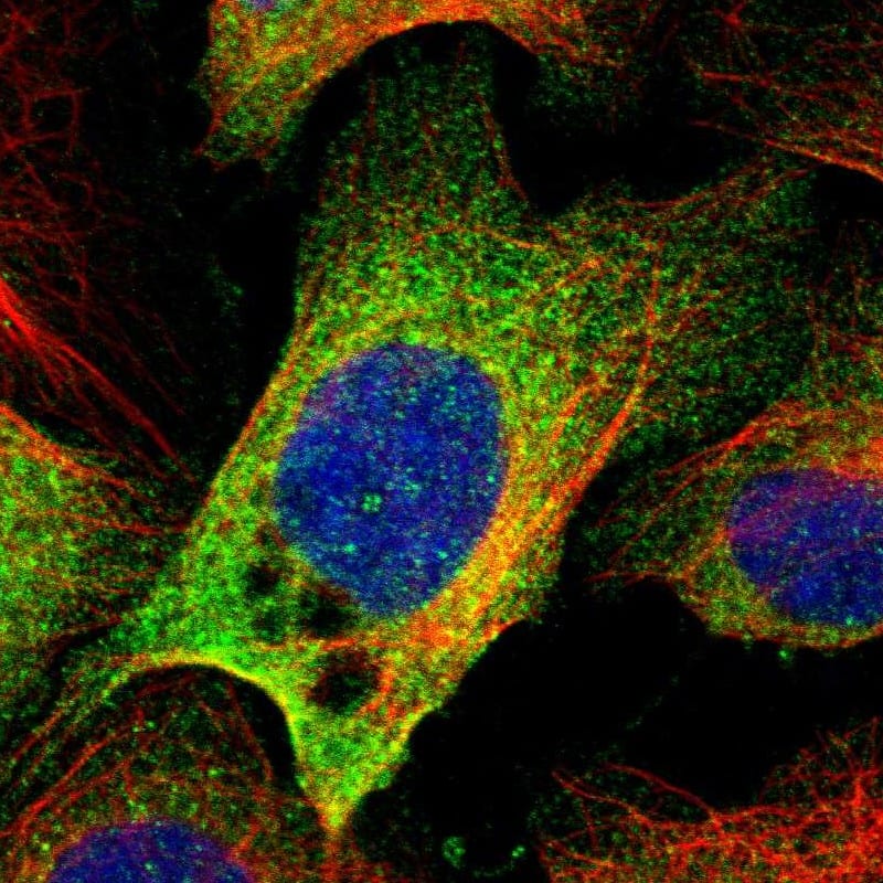 Staining of human cell line U-2 OS shows localization to cytosol.