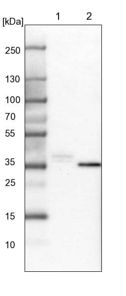 Lane 1: Mouse liver tissue lysateLane 2: Rat liver tissue lysate