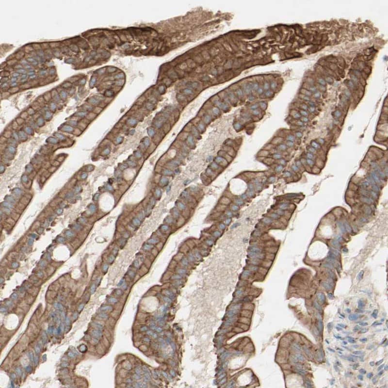 Staining of human small intestine shows moderate cytoplasmic positivity in glandular cells.