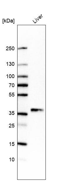 Analysis in human liver tissue.