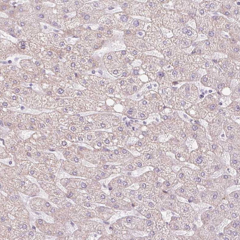 Staining of human liver shows no cytoplasmic positivity in hepatocytes as expected.