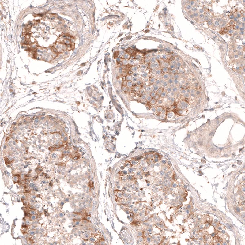 Staining of human testis shows moderate to strong cytoplasmic positivity in subsets of cells in seminiferous ducts.