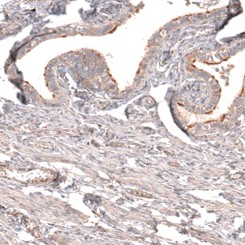Staining of human fallopian tube shows moderate to strong membranous positivity in subsets of glandular cells.