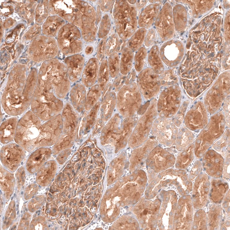 Staining of human kidney shows moderate to strong cytoplasmic positivity in cells in tubules.