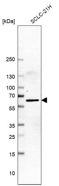 Analysis in human cell line SCLC-21H.