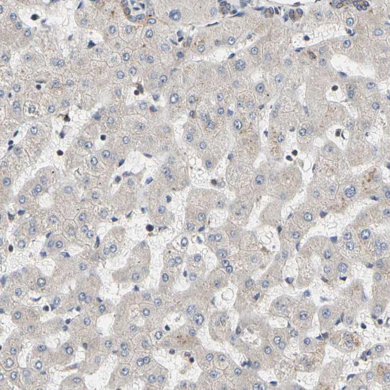 Immunohistochemistry-Paraffin GPD2 Antibody - BSA Free