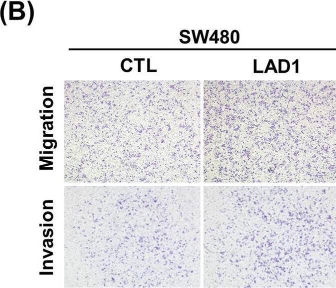 Overexpression of ectopic LAD1 promotes migration and invasion of SW480 cells in vitro. a LAD1 expression increased in SW480 cells transfected with ectopic LAD1 (LAD1) compared with counterpart cells with mock vector (CTL). b and c LAD1 overexpression increased the migration and invasion of SW480 cells determined by Transwell assays. Representative images of migrated and invaded cells are shown in (b). Relative cell numbers of migrated and invaded cells per well were normalized by the numbers of CTL cells with those of LAD1 cells (c). Error bars represent the mean standard deviation (n = 3; *, p < 0.05) Image collected and cropped by CiteAb from the following open publication (//pubmed.ncbi.nlm.nih.gov/33267790), licensed under a CC-BY license. Not internally tested by Novus Biologicals.