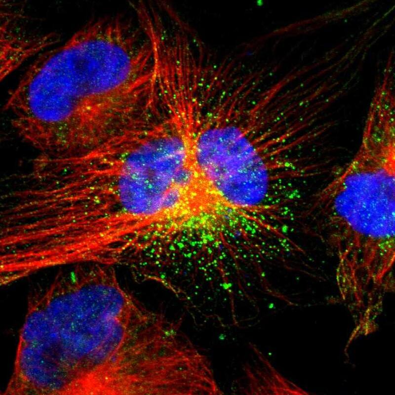 Immunocytochemistry/ Immunofluorescence ACAA1 Antibody - BSA Free