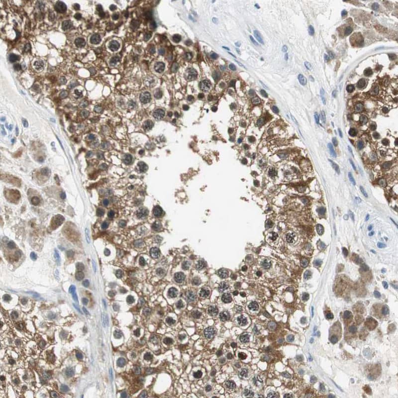 Staining of human testis shows moderate cytoplasmic positivity in cells in seminiferous ducts.